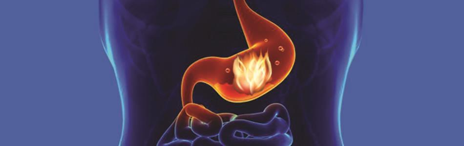 ACISTOM Herboplanet rimedi naturali bruciore di stomaco gastrite gastriti reflusso gastroesofageo anche gravidanza ulcera gastrica acidità difficoltà digestive digestione lenta difficile 